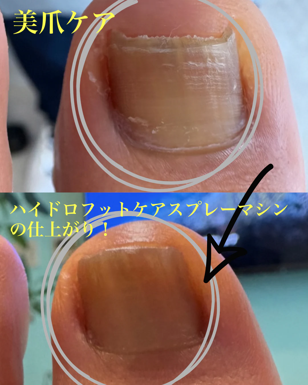 美爪ケア のサムネイル