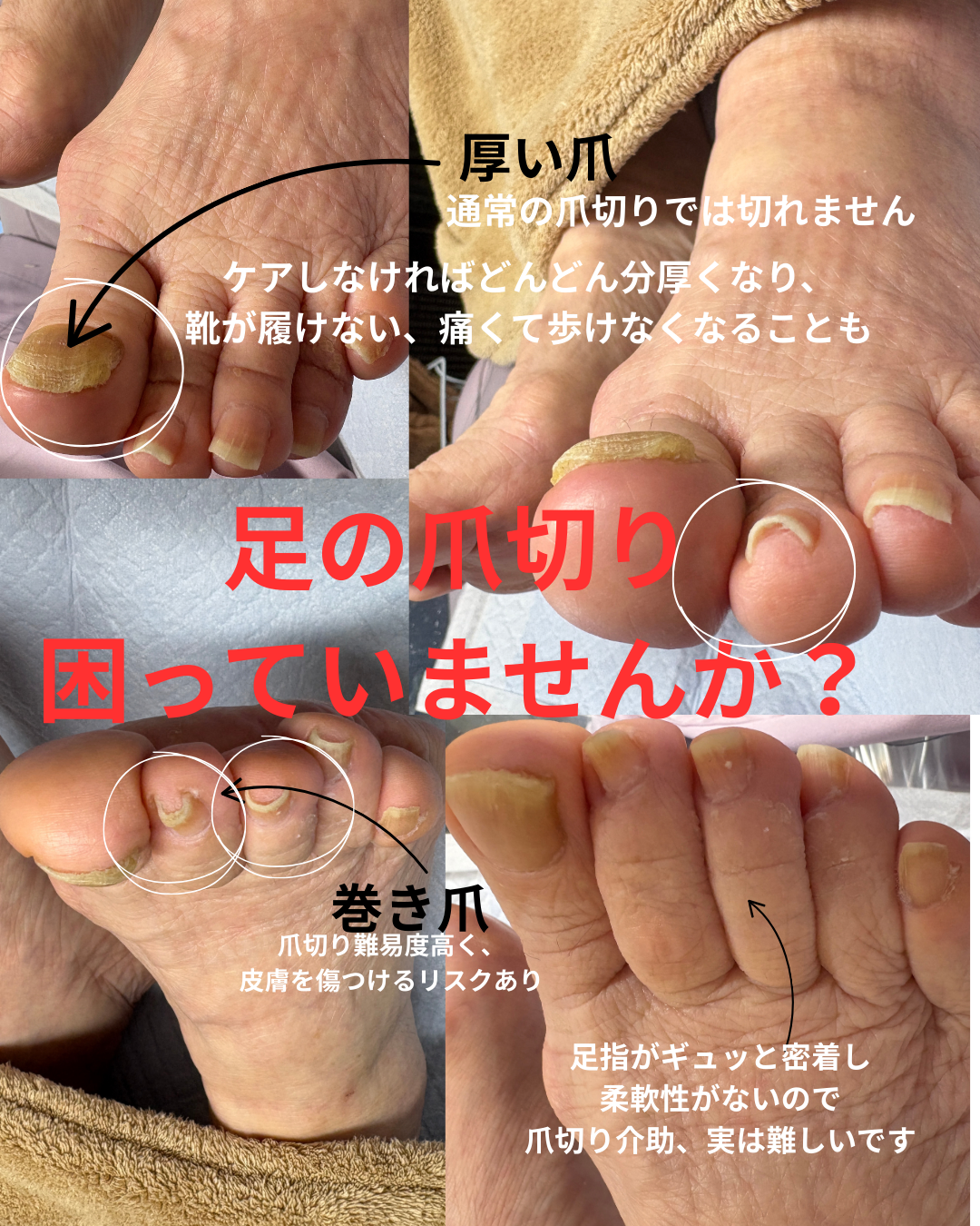 足の爪切り 困っていませんか?.png