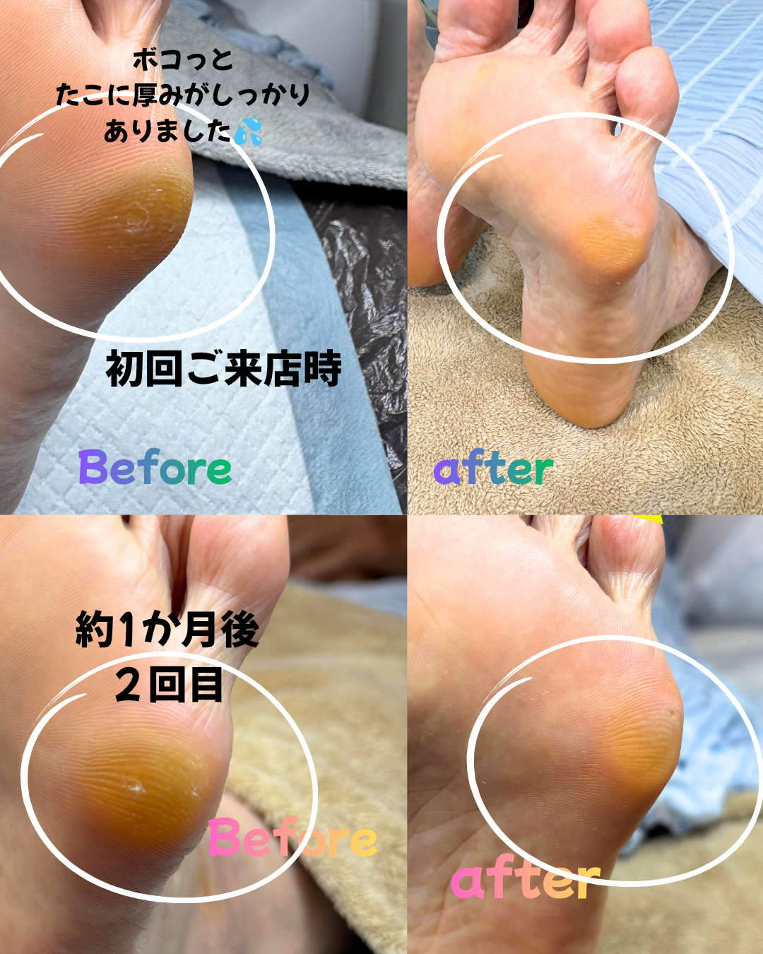 初回ご来店時.png