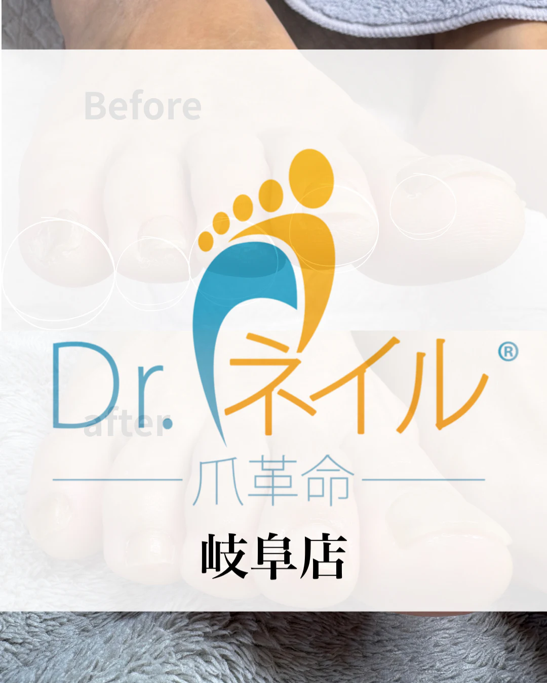 ライトな指周りの角質ケア含む美爪ケア のサムネイル