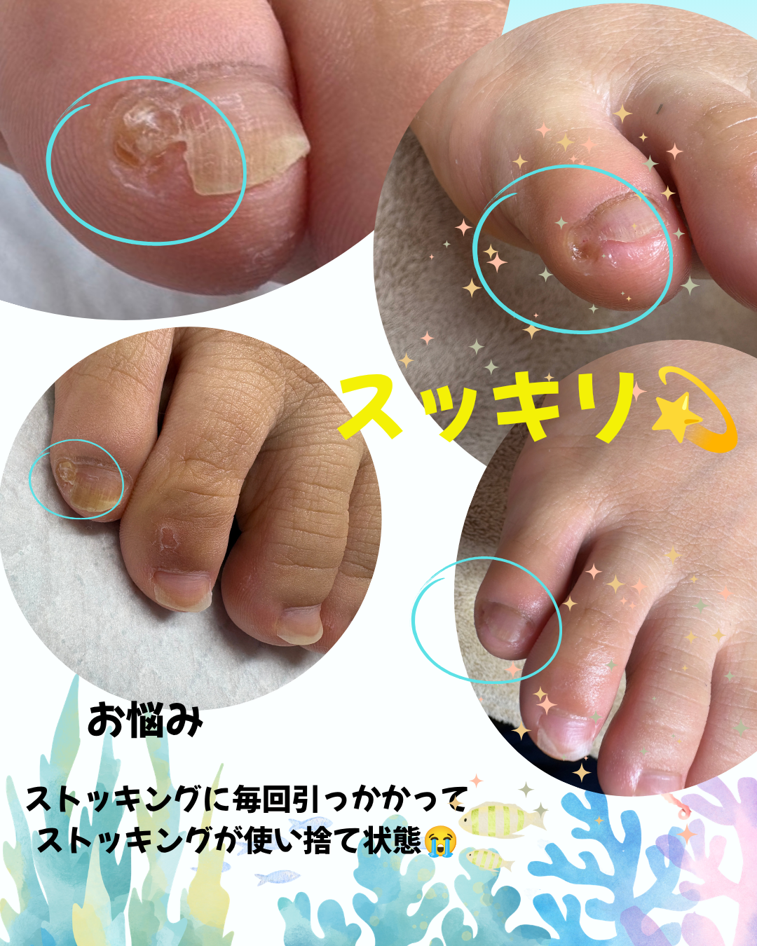 副爪 のサムネイル