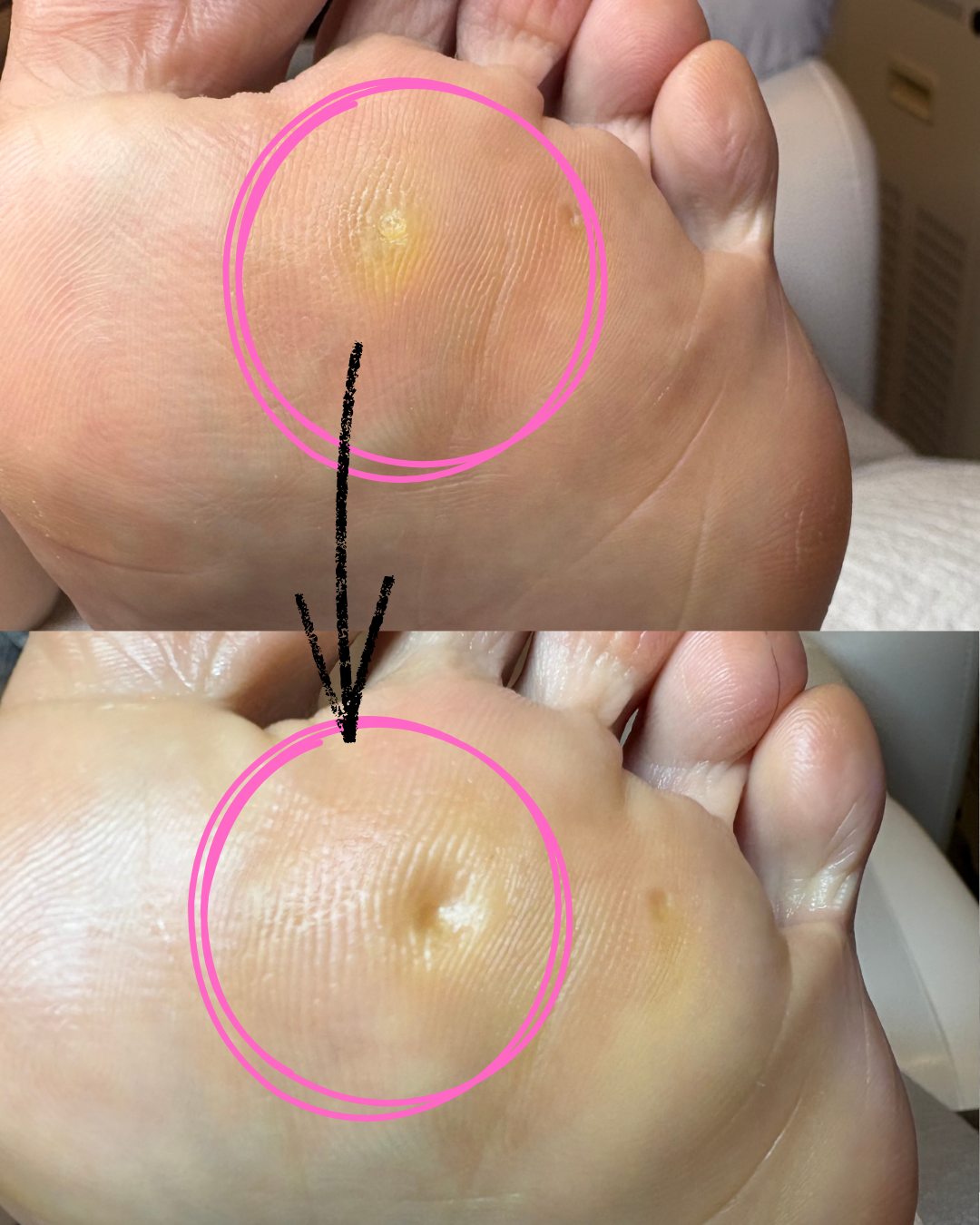 魚の目 のサムネイル