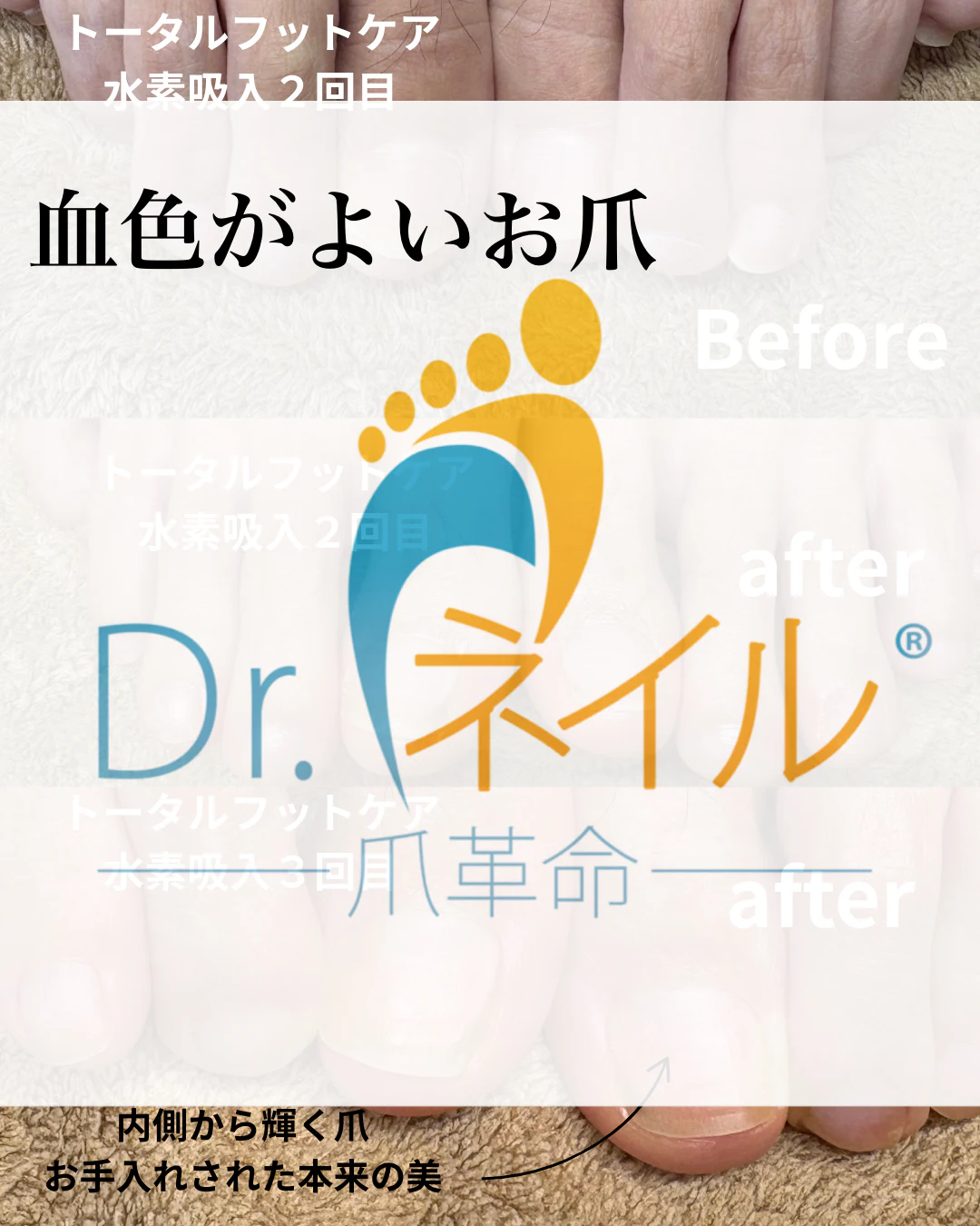 血色がよいお爪 のサムネイル