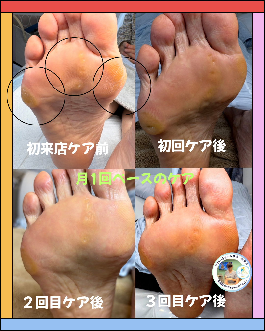 初来店ケア前.png