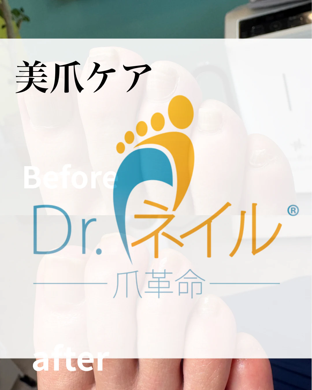 美爪ケア のサムネイル