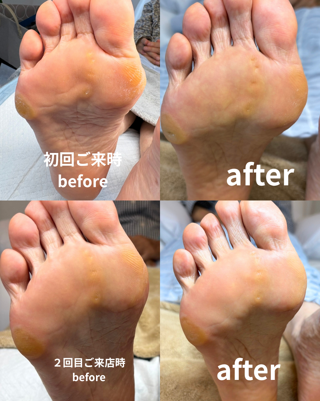 メンテナンストータルフットケア のサムネイル