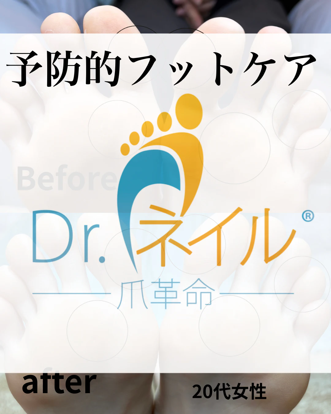 予防的フットケア のサムネイル
