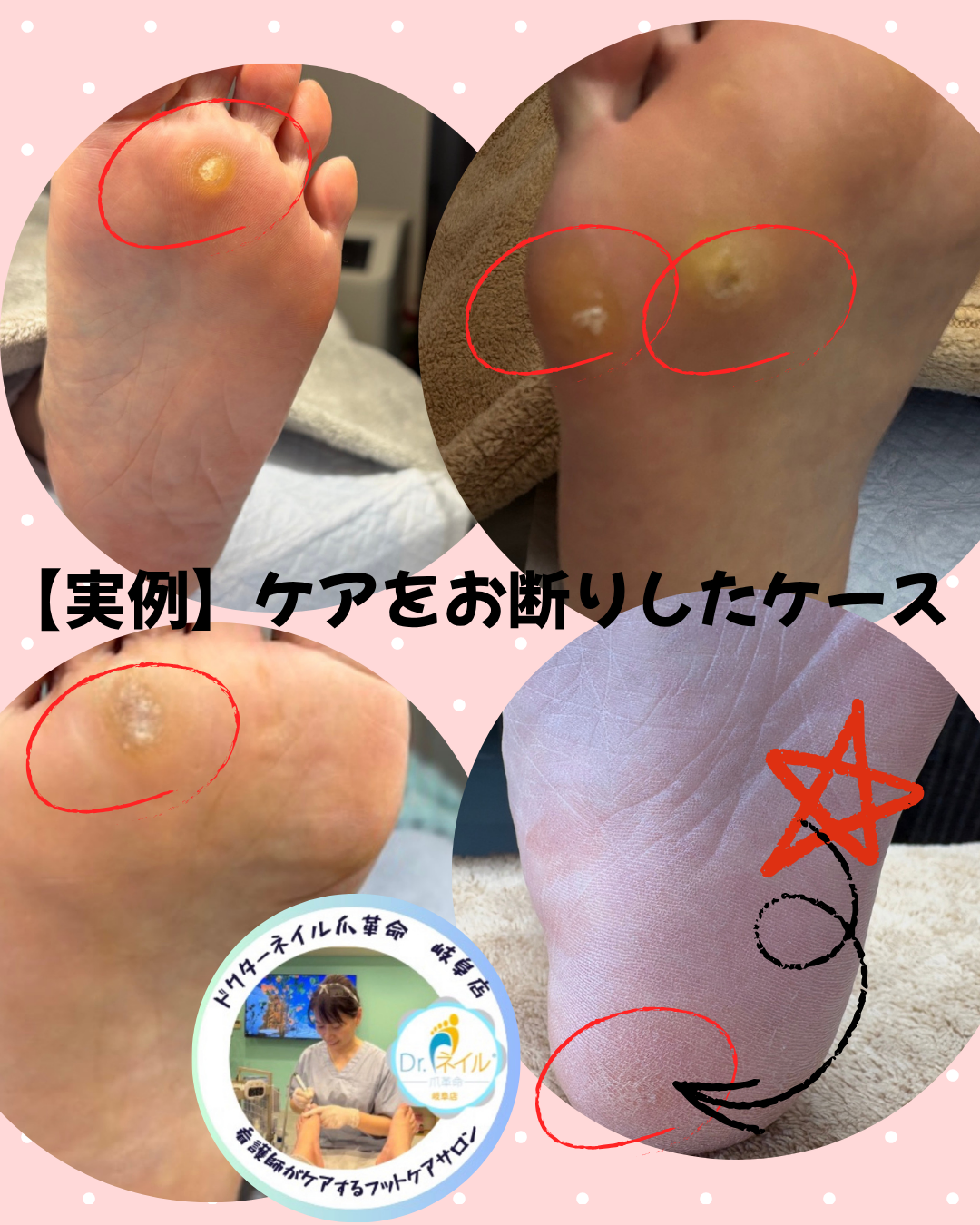 ケアをお断りした実例 のサムネイル